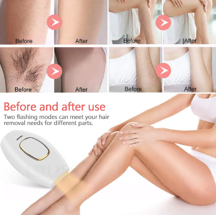 Skinelux IPL Full Body Laser Hair Removal Device Handset